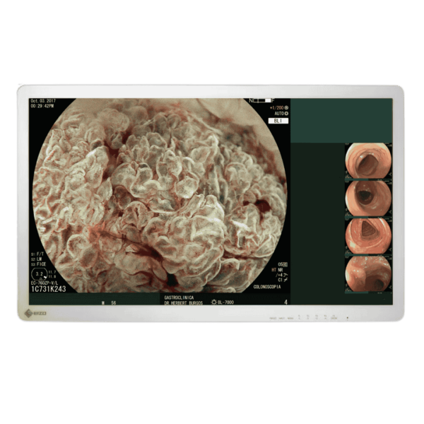 EX2721 | PANTALLA CuratOR 27" HD