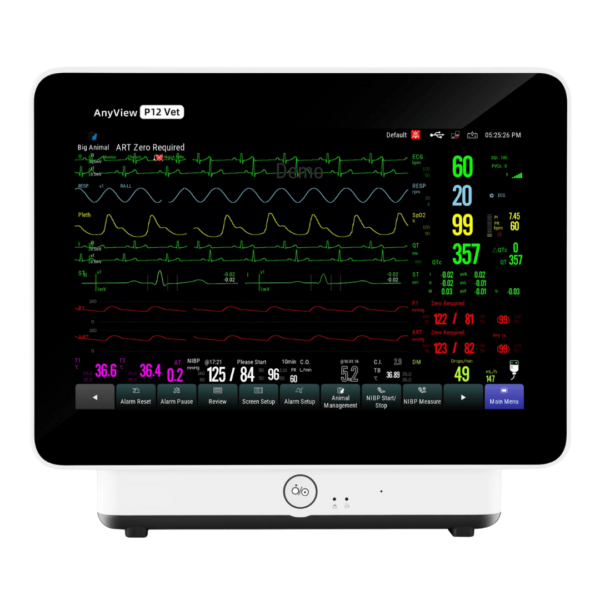 P12 | Monitor de Signos Vitales Modular de Alta Gama