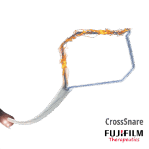 CrossSnare | Asa de Polipectomía FRIA y CALIENTE