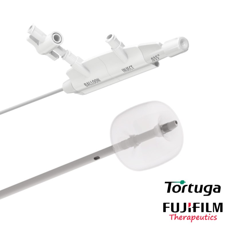 TORTUGA | Balón Extractor